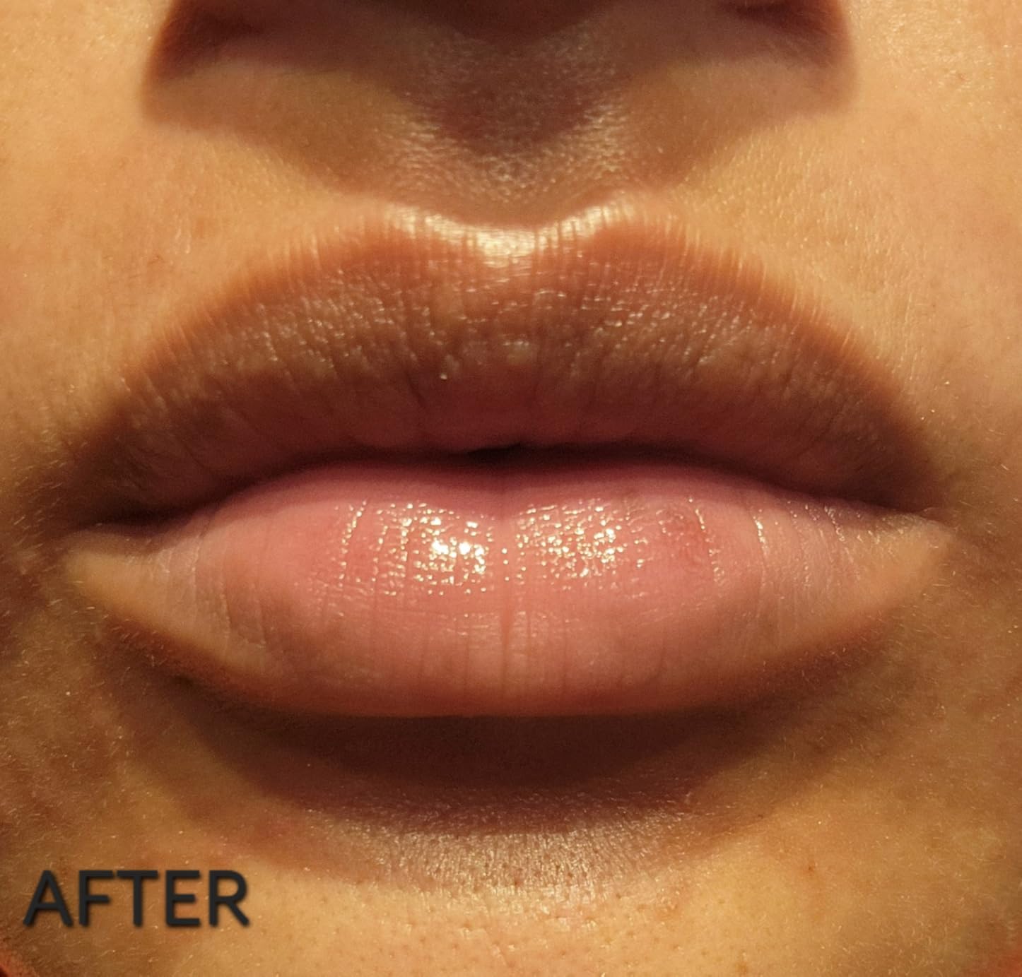 EnaSkin Dark Spot Corrector & Remover Serum for Face & Body, Niacinamide customer photo 1
