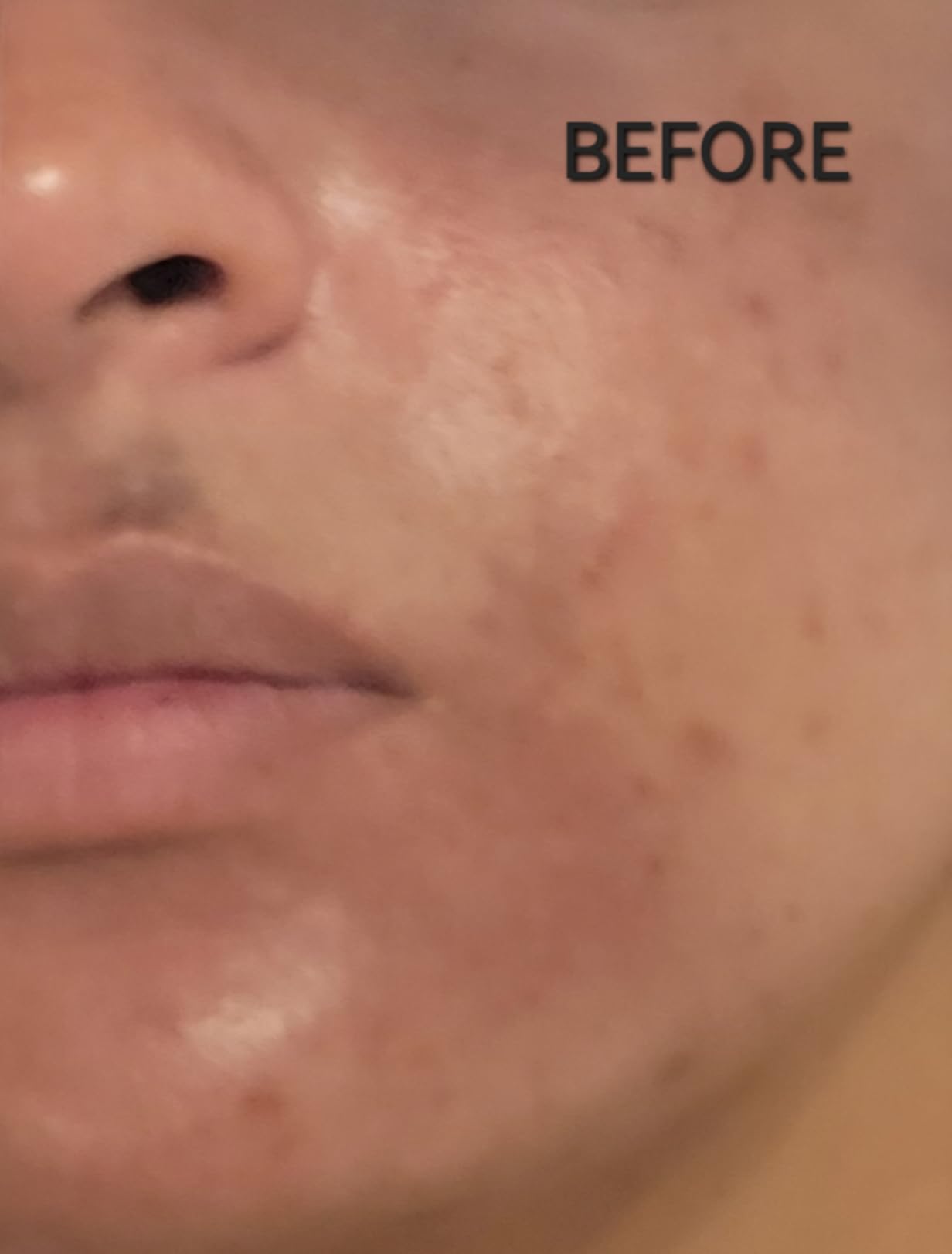 EnaSkin Dark Spot Corrector & Remover Serum for Face & Body, Niacinamide customer photo 2