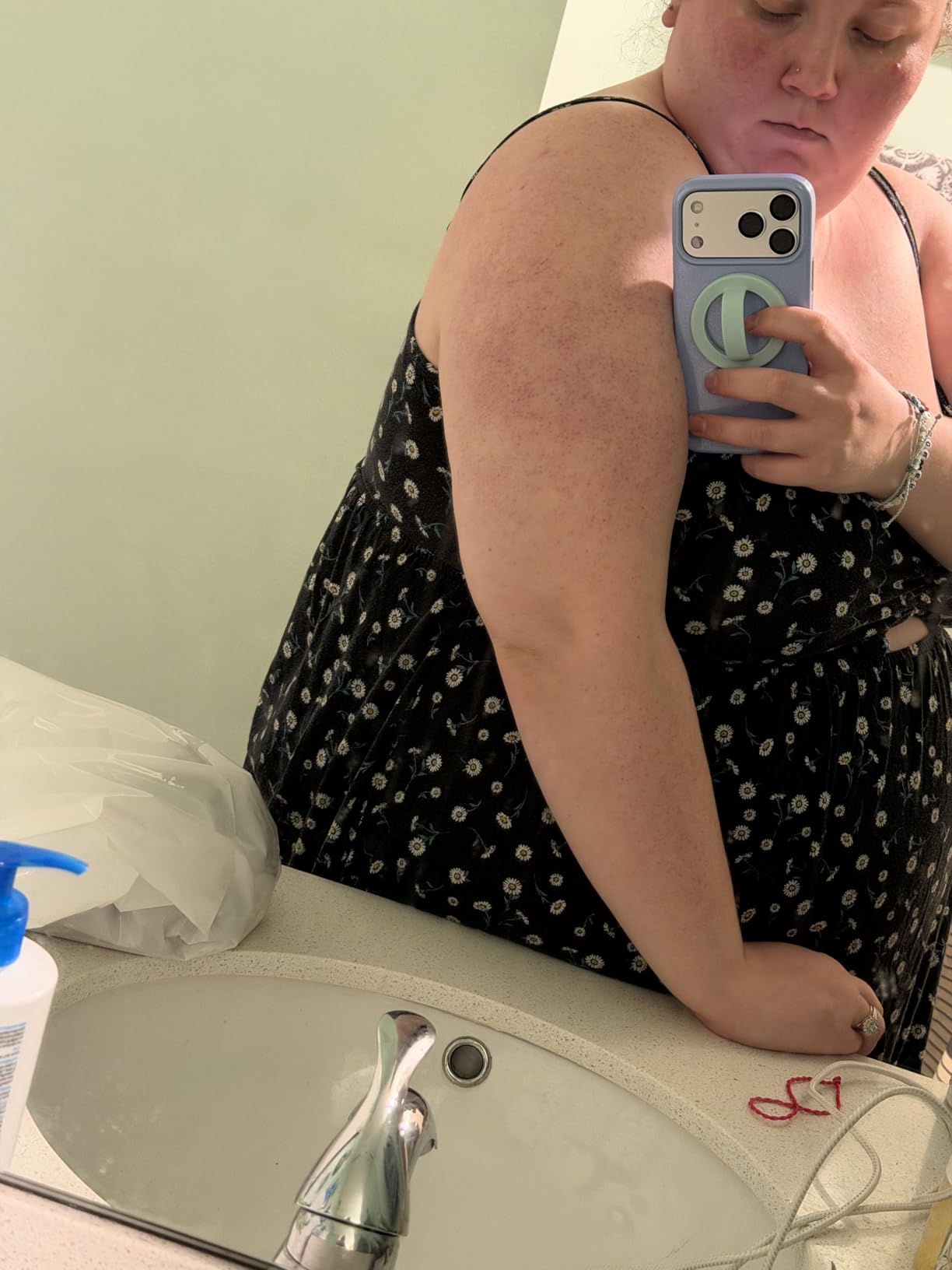 First Aid Beauty KP Bump Eraser Scrub, 10% AHA, Sensitive Skin customer photo 2